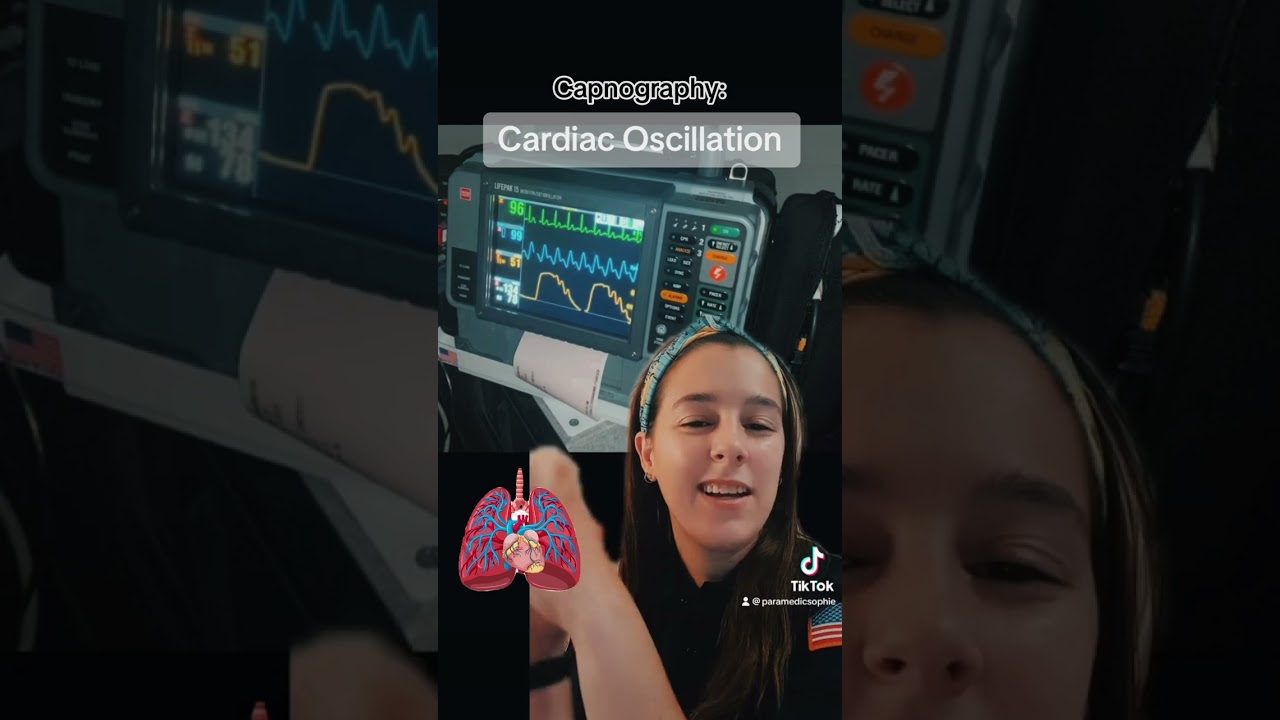Capnography: Cardiac Oscillations.  