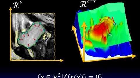 Bilateral Hermite Radial Basis Function for contour-based volume segmentation