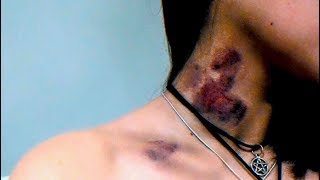 Cutworm ╺╸ The Mutable Scar