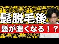 知らないと焦る髭脱毛受けた後の注意点をいくつか解説!