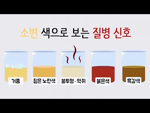 내 몸이 보내는 건강적신호…소변 상태로 보는 질병 / YTN 사이언스