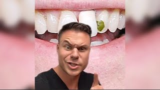 Orthodontist Reacts Woman Finds Crazy Thing Growing In Mouth