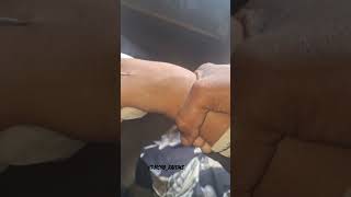 How to Insert iv Cannula child Technique #Nursing #Reels #Viral #Trending #Project #short