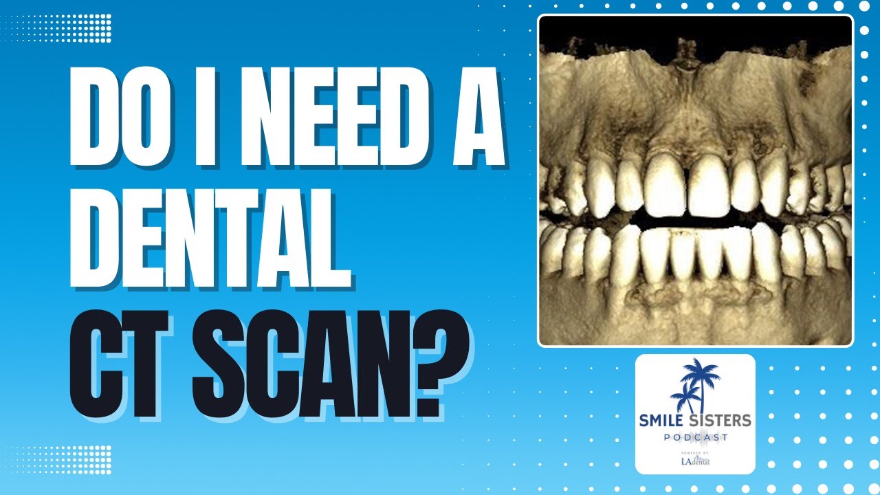 Do I Need a Dental CT Scan? - Smile Sisters Podcast