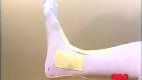 3M™ Scotchcast™ Soft Cast Casting Tape: Ankle Wrap Application and Removal