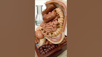 3D Animation of Constipation Explained | Gut Health