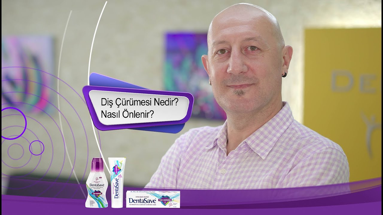 Diş Çürümesi Nedir? Nasıl Önlenir?