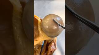 Look At the Inside of This Shoulder!