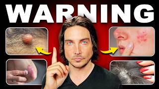 10 Signs Your Body Needs To Go Raw Vegan (DO NOT IGNORE)