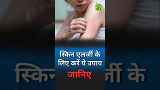Skin Allergy Treatment at Home – No Chemicals | Vedic Upchar | @anilbansalayurveda | #skincare screenshot 1
