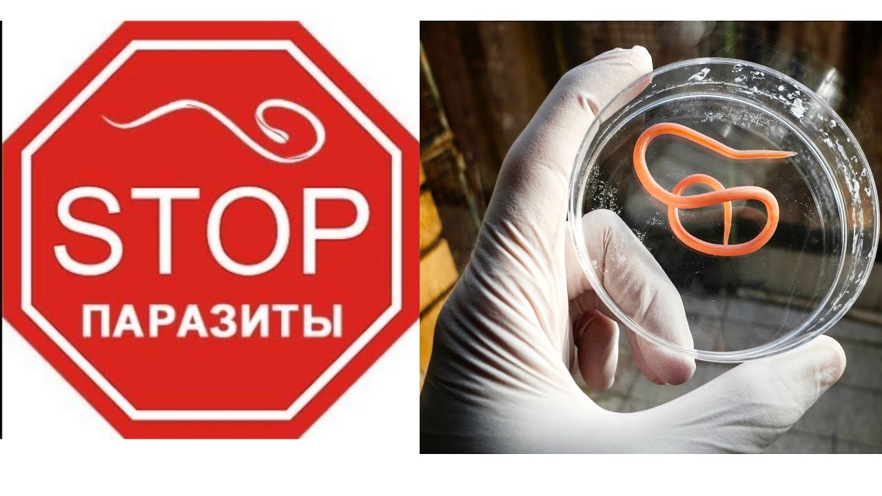 Как вывести паразитов/аскарид?
