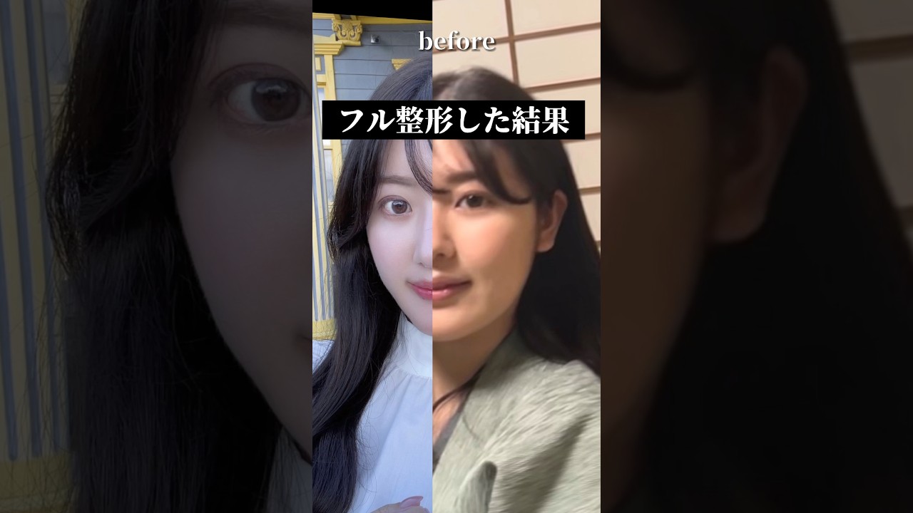 フル整形した結果成功しすぎた #shorts #整形 #ギャル #垢抜け #淡色