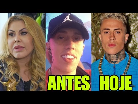 9 CELEBRITIES WHO HAD FACIAL HARMONIZATION AND ARE UNRECOGNIZABLE