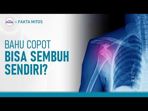 Handling a Dislocated Shoulder: Can It Pop Back In on Its Own? | Hidup Sehat tvOne