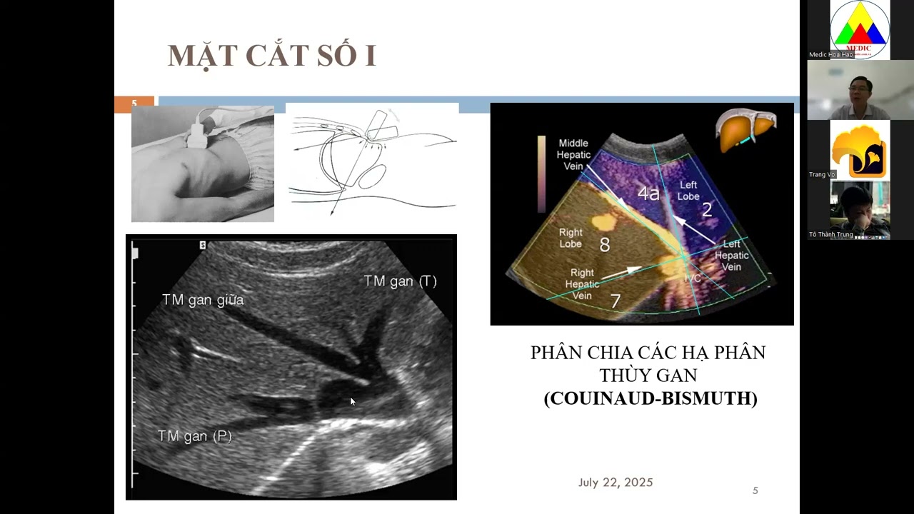 SAOB-kỹ thuật khám& GP SA (phần2 bs Thanh Liêm Medic) 22/7/25