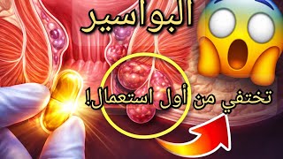 الحل النهائي للبواسير في المنزل 😱 ودّع الألم نهائياً بدون طبيب أو جراحة! screenshot 2