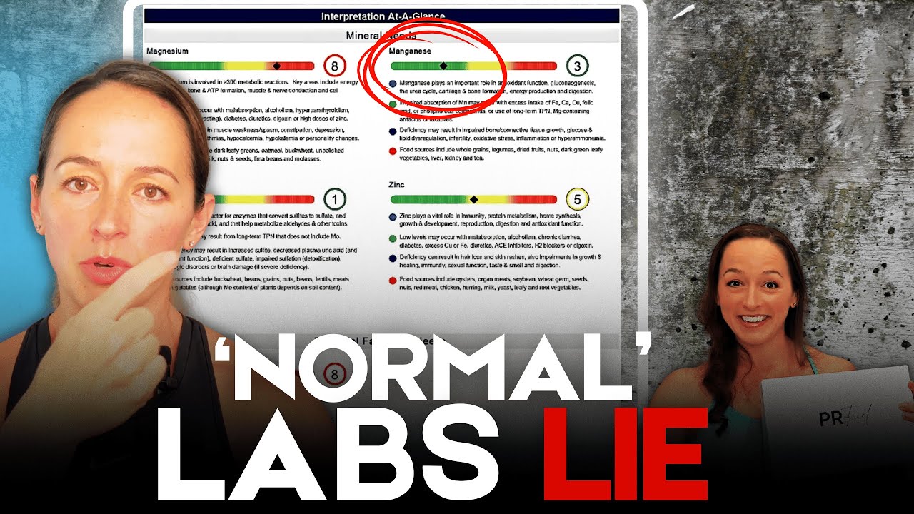 My Mold Toxicity Symptoms / Healing Results (1 Year Later)