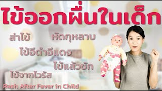 ไข้ออกผื่นในเด็ก Rash After Fever in Child