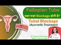 Fallopian Tube कहां कहां Blockage होती है। Ayurveda For Fallopian Tube Blockage I @DrRuchiAyurveda