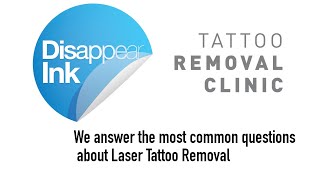 Details The Most Common Questions About Laser Tattoo Removal Answered! Update