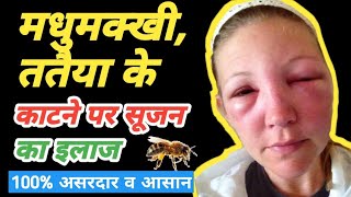 #healthtipsinhindi #gharelunuskhe मधुमक्खी काटने से सूजन का इलाज| Bhird ke katne par kya kare