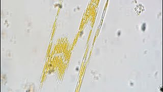 Bacillaria Hysteria