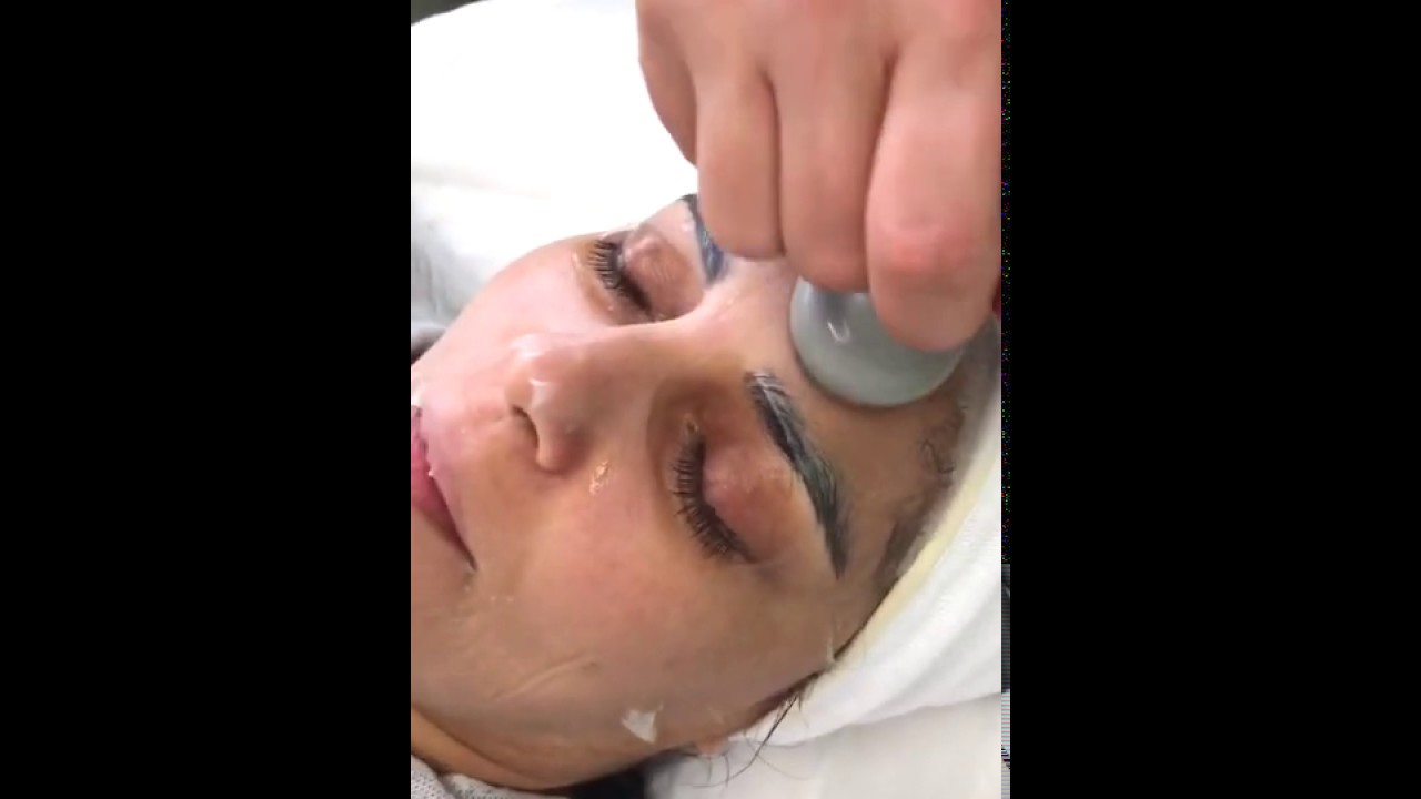 Skin Rejuvenation Treatment: OxyGeneo 3-in-1 | Peptide Peel | Dermaroller Mask