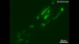 Time-lapse imaging of tangentially migrating neuroblasts in the adult RMS.