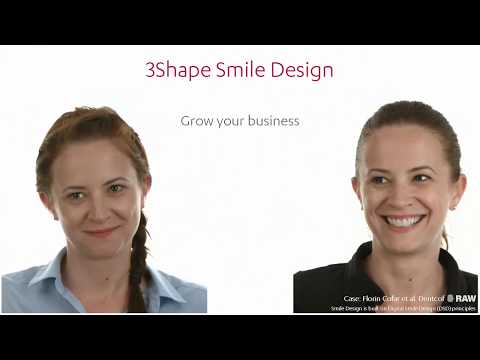 Digital Smile Design LONDON-MIAMI-DEBRECEN-BUDAPEST with 3shape