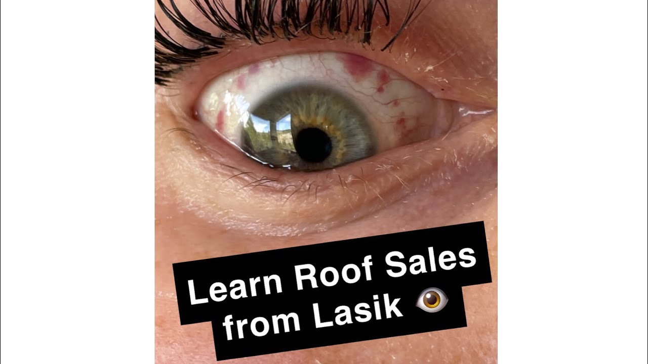 Eye Doctor Teaches Important Roof Sales Lesson 👁