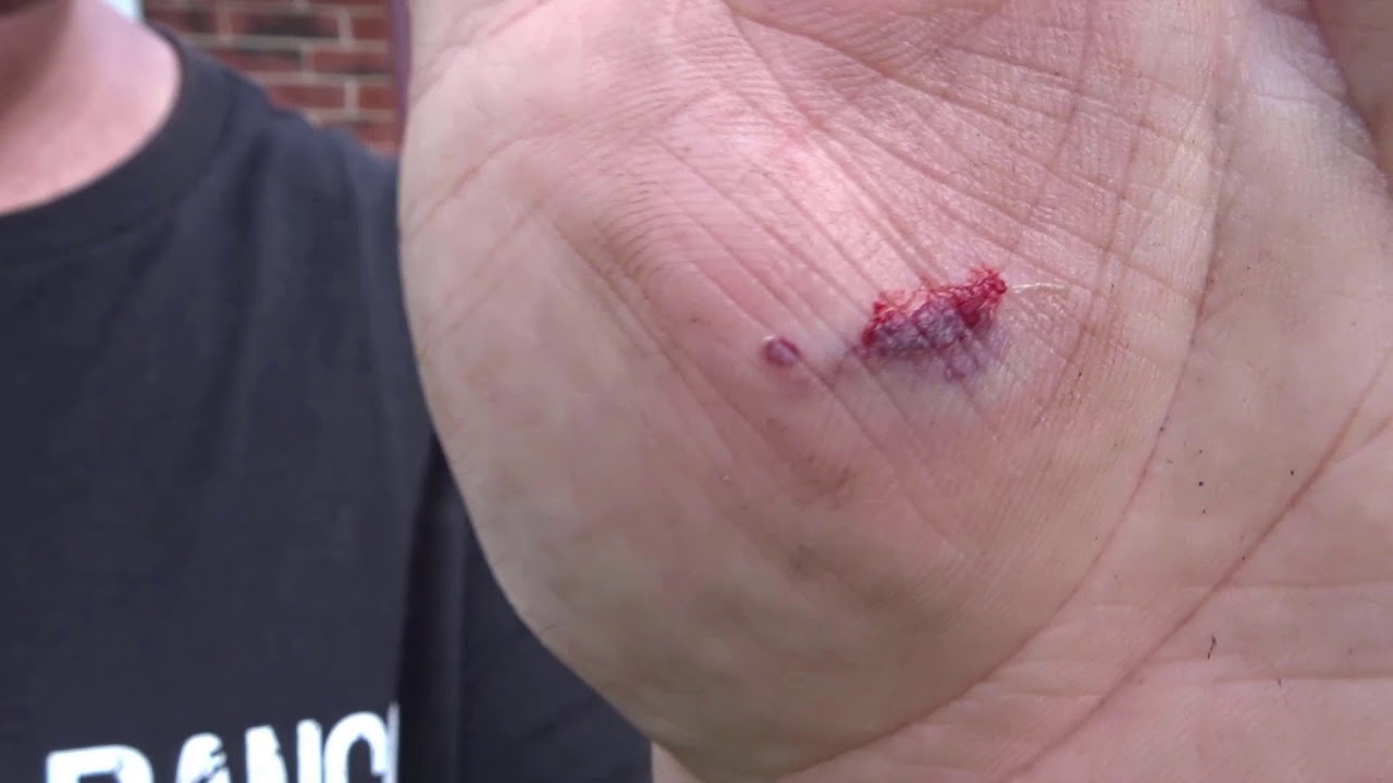 Injury and crying Pneumatic Dent Puller/Slid Hammer Item 69718 Injury