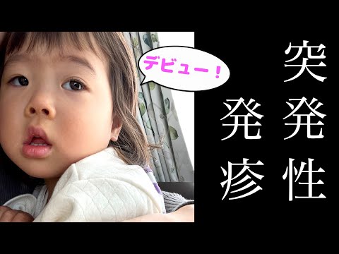 【今頃デビュー！？】｜２歳を過ぎて突発性発疹になりました。