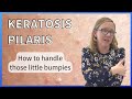 Pediatric Dermatologist explains Keratosis Pilaris - those little bumpies on the skin