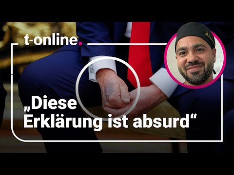 Donald Trumps Gesundheitszustand in der Analyse