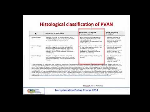 Video: Frühe Fulminante BK-Polyomavirus-assoziierte Nephropathie Bei Zwei Nierentransplantationspatienten Mit Niedrigen Neutralisierenden Antikörpertitern, Die Allotransplantate Vom Gleic