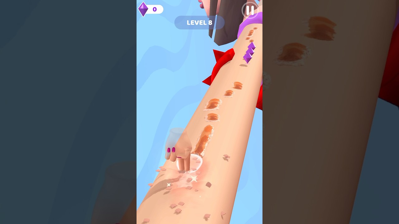 The Hyper Acne Runner Level 8 