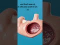 #kidney #kidneyhealth #kidneydisease #concious#concern#hospital#yash#doctor #specialistdoctor