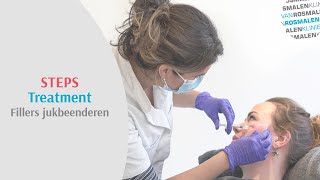 Steps Treatment Fillers Jukbeenderen Hoe Gaat Een Jukbeen Behandeling In Zijn Werk?