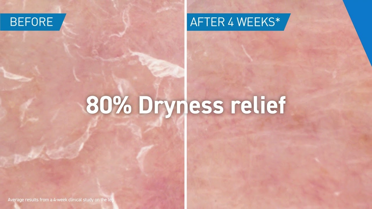 Cerave Moisturising Cream - 48h Hydration & Stronger Skin Barrier in 1H