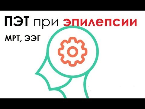 Диагностика эпилепсии - сравнение методов исследований при эпилепсии: ПЭТ, МРТ, ЭЭГ