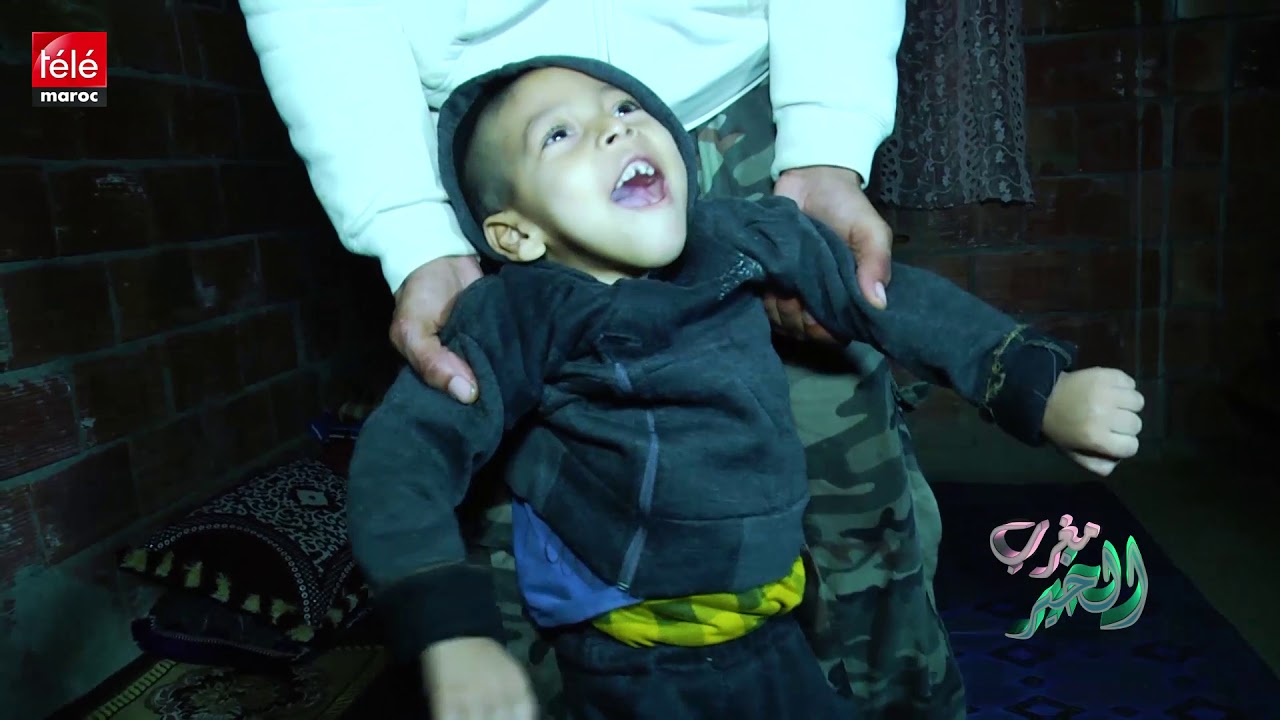 والد طفل معاق : 