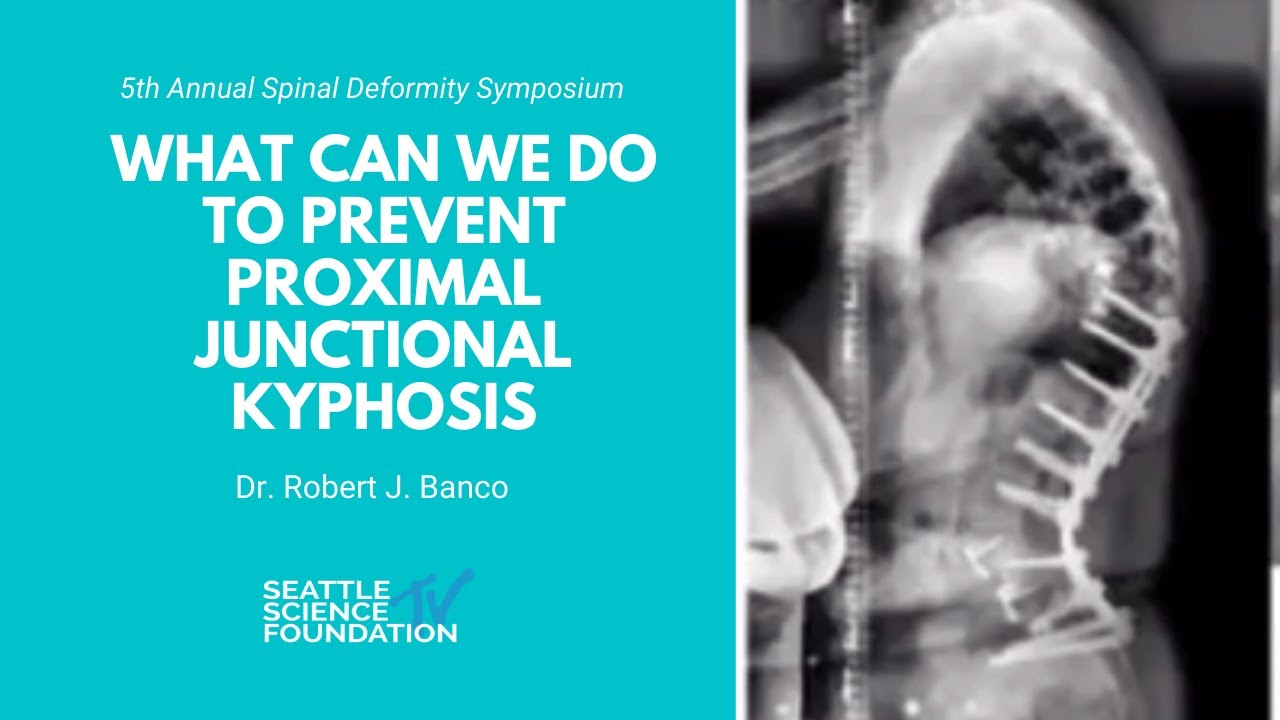 What Can We Do To Prevent Proximal Junctional Kyphosis Robert J