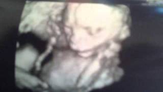 My Pregnancy slide show (BFP to 28 weeks)