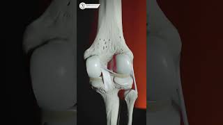 Google किंवा AI वरून स्वतःच डॉक्टर बनताय? सावधान! ⚠️ #orthopediccare