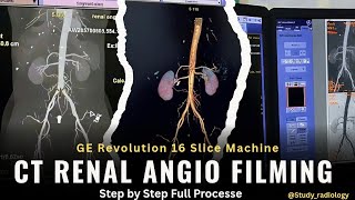 CT Renal Angio Filming On GE Revolution 16 Slice Machine | Full Process | @Study_Radiology 