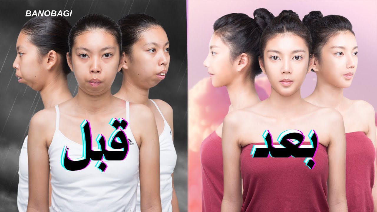 قبل وبعد عملية الفك في كوريا! النتيجة صادمة