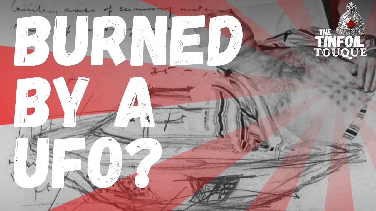 Burned by a UFO? The Falcon Lake Incident