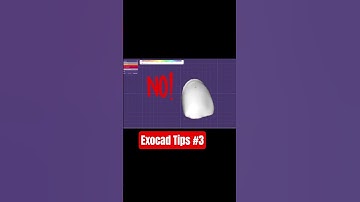 Exocad Tips #3 #dentist #anatomy #dentalcaddesign #smiledesigndental #dentallab #exocad
