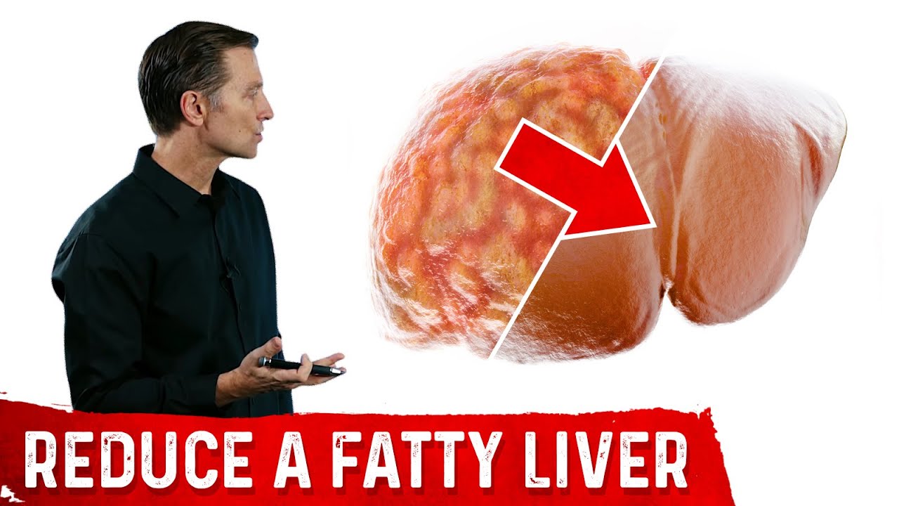 The Best Fatty Liver Exercise Treatment Of Fatty Liver Dr Berg 