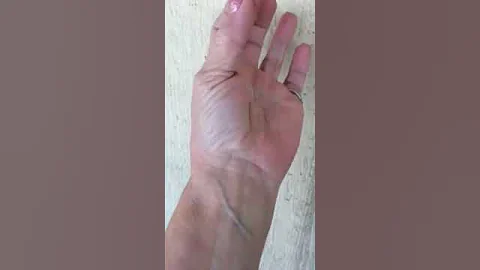 Carpal Tunnel Exercise by Vicki Peters